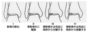 cartilage_disorder_1